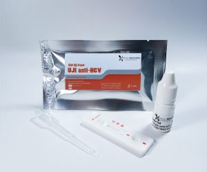 UJI anti-HCV